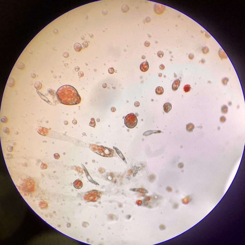 Erlichia Canis